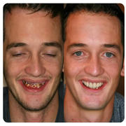 Poudre minérale de blanchiment des dents, soins complets et profonds dentaire.
